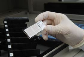Researcher checks slide in Mason lab